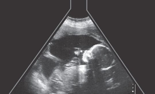 Ultrasight – A Sadhaks Experience