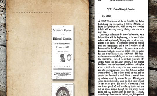 How world learnt the art of plastic surgery